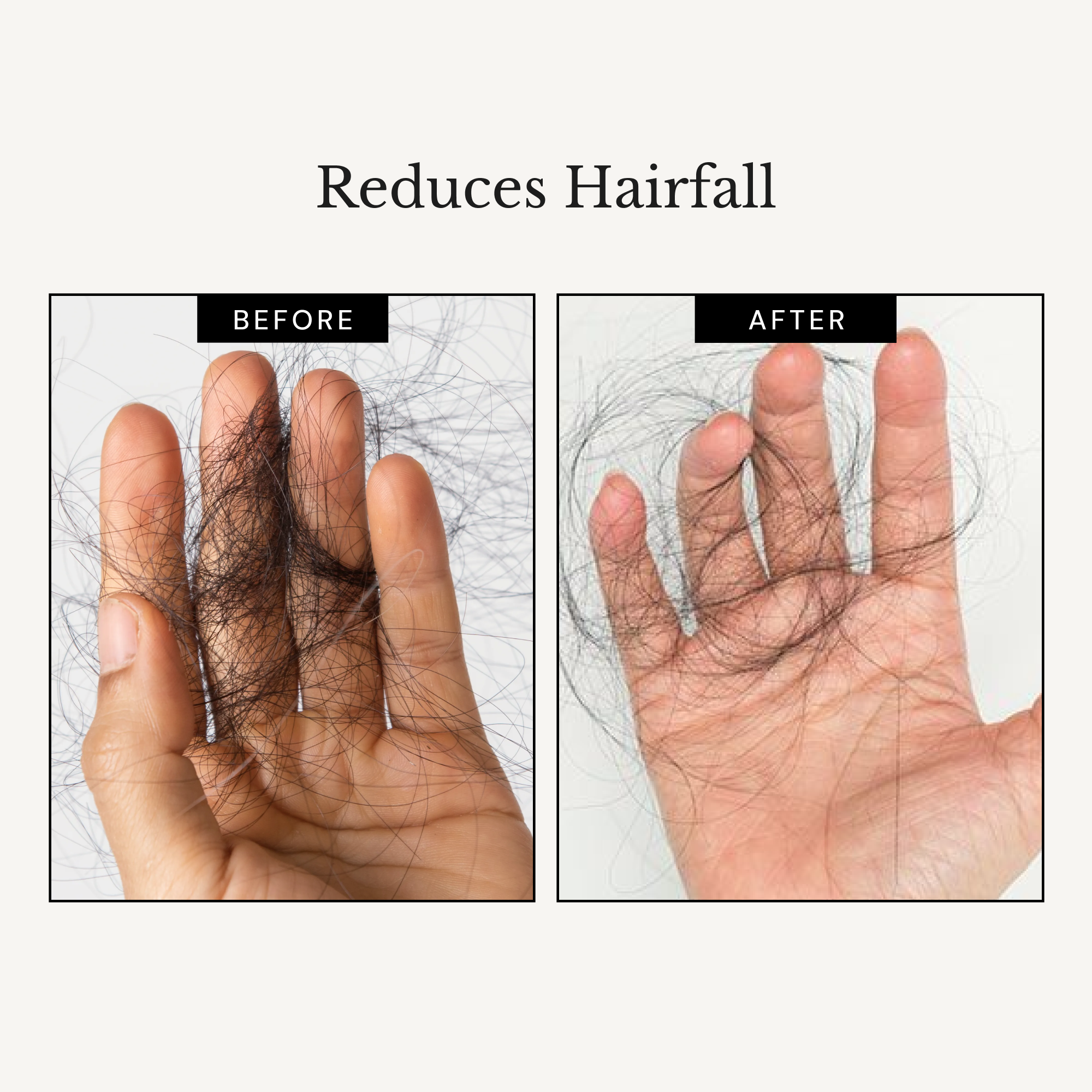 Richfeel Scalp Cleanser with Saw Palmetto | Anti-Hair Fall Shampoo