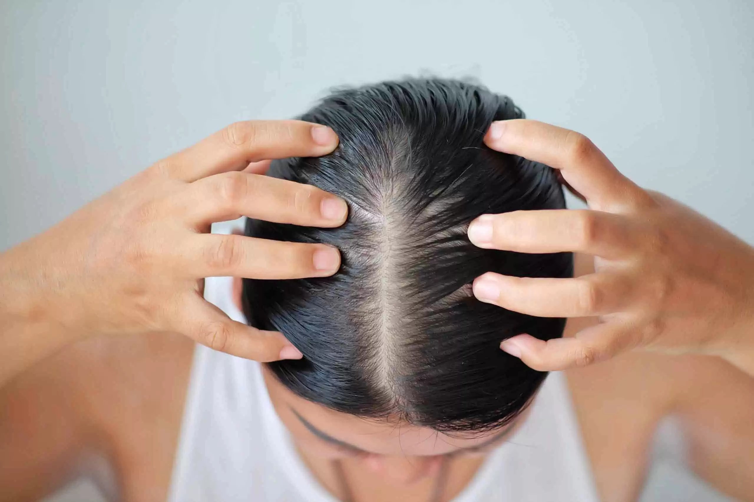 Best Hair Regrowth for Women: How to Restore Volume Without Harsh Chemicals
