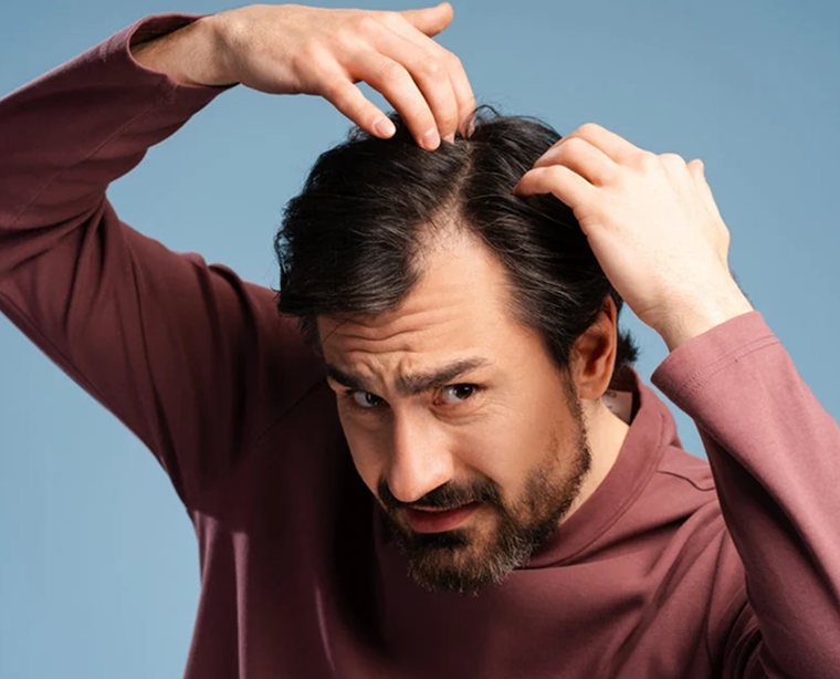 Effective Ways to Control Hair Fall for Men