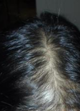 Month 8