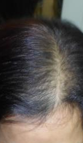 Month 9