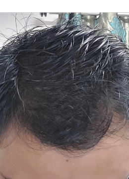 Month 12