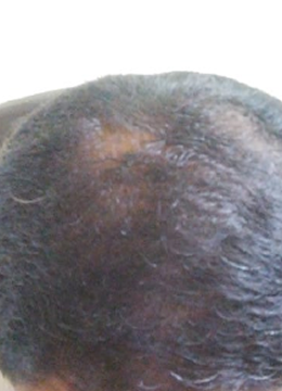 Month 8