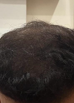 Month 9